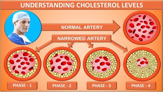 Understanding Cholesterol Levels